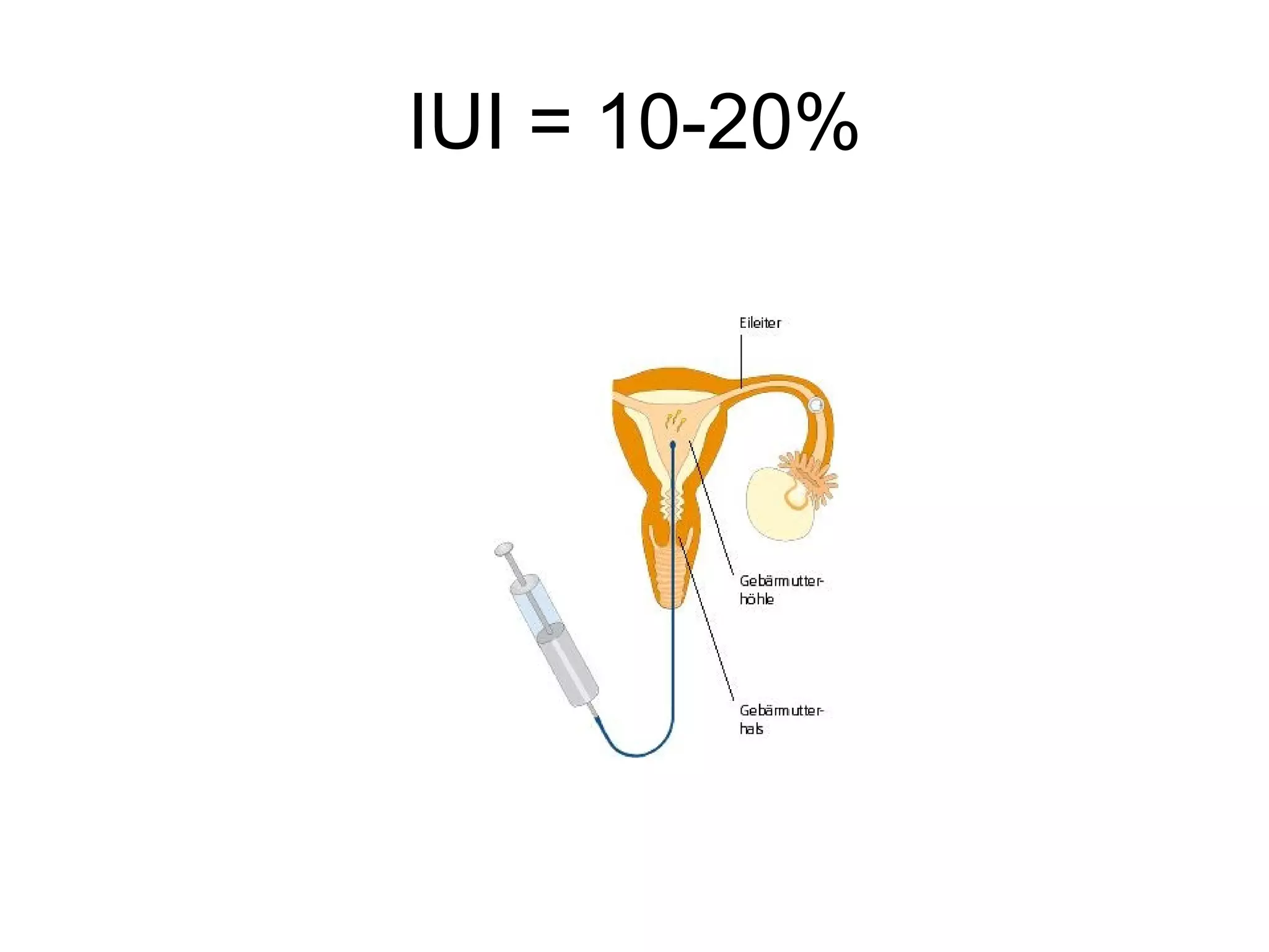 IUI = 10-20%