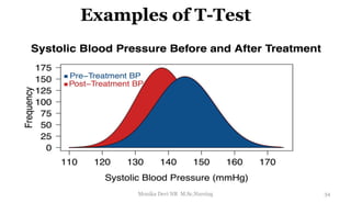Examples of T-Test
34
Monika Devi NR M.Sc.Nursing
 