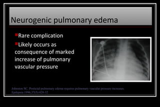 Neurogenic pulmonary edema
Rare complication
Likely

occurs as
consequence of marked
increase of pulmonary
vascular pressure

Johnston SC. Postictal pulmonary edema requires pulmonary vascular pressure increases.
Epilepsia 1996;37(5):428-32

 