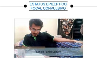 ESTATUS EPILEPTICO
FOCAL CONVULSIVO
 