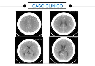 CASO CLINICO
 