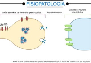 Axón terminal de neurona presináptica
Dendrita de neurona
postsinápticaEspacio sináptico
Na+ Na+Na+
Na+
Fisher RS, et al. Epileptic seizures and epilepsy: definitions proposed by ILAE and the IBE. Epilepsia. 2005 Apr. 46(4):470-2
FISIOPATOLOGIA
 