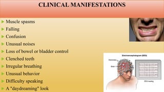 CLINICAL MANIFESTATIONS
 Muscle spasms
 Falling
 Confusion
 Unusual noises
 Loss of bowel or bladder control
 Clenched teeth
 Irregular breathing
 Unusual behavior
 Difficulty speaking
 A "daydreaming" look
 
