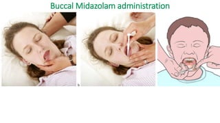 Buccal Midazolam administration
 