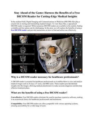 Stay Ahead of the Game: Harness the Benefits of a Free
DICOM Reader for Cutting-Edge Medical Insights
In the medical field, Digital Imaging and Communications in Medicine (DICOM) files play a
crucial role in storing and transmitting medical images. To view these files, a specialized
DICOM reader is required. While numerous DICOM readers are available in the market, finding
a reliable and free option can be challenging. In this post, we will explore the benefits of using a
free DICOM reader and provide instructions on how to find and utilize one effectively.
Why is a DICOM reader necessary for healthcare professionals?
A DICOM reader is essential for healthcare professionals as it enables them to view and analyze
medical images such as X-rays, CT scans, and MRI scans. These readers provide detailed
insights into the images, allowing medical practitioners to make accurate diagnoses and develop
effective treatment plans.
What are the benefits of using a free DICOM reader?
Cost-effective: Free DICOM readers eliminate the need to purchase expensive software, making
it an economical choice for healthcare professionals and institutions.
Compatibility: Free DICOM readers are often compatible with various operating systems,
ensuring accessibility for a wide range of users.
 