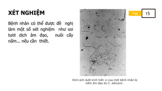 Page 15
XÉT NGHIỆM
Bệnh nhân có thể được đề nghị
làm một số xét nghiệm như soi
tươi dịch âm đạo, nuôi cấy
nấm... nếu cần thiết.
Hình ảnh dưới kính hiển vi của một bệnh nhân bị
viêm âm đạo do C. albicans .
 