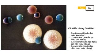 Có nhiều chủng Candida:
- C. albicans (khuẩn lạc
màu xanh lục)
- C.tropicalis (khuẩn lạc
màu tím xanh)
- C. krusei (khuẩn lạc dạng
sợi, lớn màu hồng)
- C. glabrata (khuẩn lạc
nấm men màu hồng)
Page 26
 