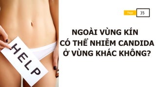 Page 35
NGOÀI VÙNG KÍN
CÓ THỂ NHIỄM CANDIDA
Ở VÙNG KHÁC KHÔNG?
 