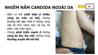 - Nấm có thể xuất hiện ở nhiều
vùng da trên cơ thể, nhưng
thường bắt gặp nhất ở những vùng
nếp kẽ như: nách, bẹn, kẽ tay, kẽ
chân, nếp chân ngực...
- Chúng phát triển mạnh ở những
vùng da ấm, ẩm ướt, những vùng
thường xuyên đổ mồ hôi.
Page 40
NHIỄM NẤM CANDIDA NGOÀI DA
 