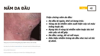 NẤM DA ĐẦU
Triệu chứng nấm da đầu:
● Da đầu bị ngứa, khô và bong tróc.
● Vùng da bị nhiễm nấm xuất hiện vảy và màu
trắng hoặc đỏ.
● Rụng tóc ở vùng bị nhiễm nấm hoặc tóc trở
nên yếu và dễ gãy.
● Da đầu: sưng, đỏ và nổi mụn.
● Dấu hiệu nhiễm trùng da đầu như mủ và tóc
bị dính.
Page 48
 