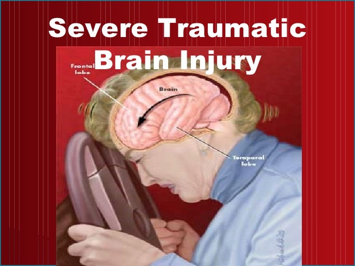 of brain damage case study