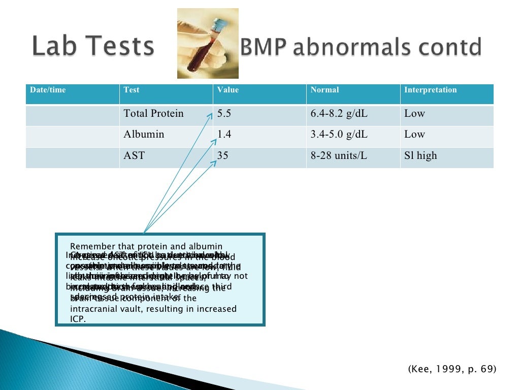 Head injury in pediatric slideshare image