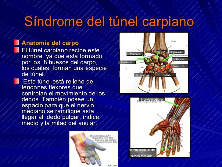 SINDROME DEL TUNEL CARPIANO SINDROME DEL TUNEL CARPIANO