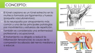  El túnel carpiano es un túnel estrecho en la
muñeca formado por ligamentos y huesos
(paquete vasculonervioso).
 Es la n...