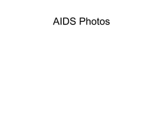 AIDS Photos
 