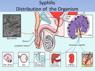 Syphilis
Distribution of the Organism
 