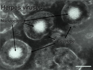 Herpes viruses

Nucleocapsid



                 Envelope
 