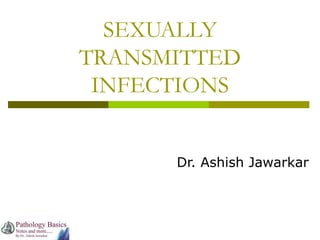 SEXUALLY
TRANSMITTED
INFECTIONS
Dr. Ashish Jawarkar
 