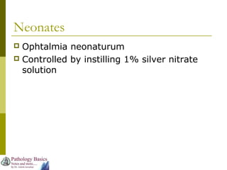 Neonates
 Ophtalmia neonaturum
 Controlled by instilling 1% silver nitrate
solution
 