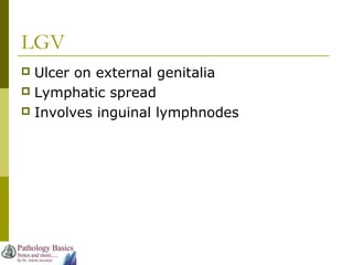 LGV
 Ulcer on external genitalia
 Lymphatic spread
 Involves inguinal lymphnodes
 