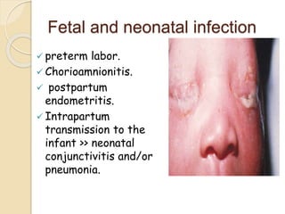Fetal and neonatal infection
 preterm labor.
 Chorioamnionitis.
 postpartum
endometritis.
 Intrapartum
transmission to the
infant >> neonatal
conjunctivitis and/or
pneumonia.
 