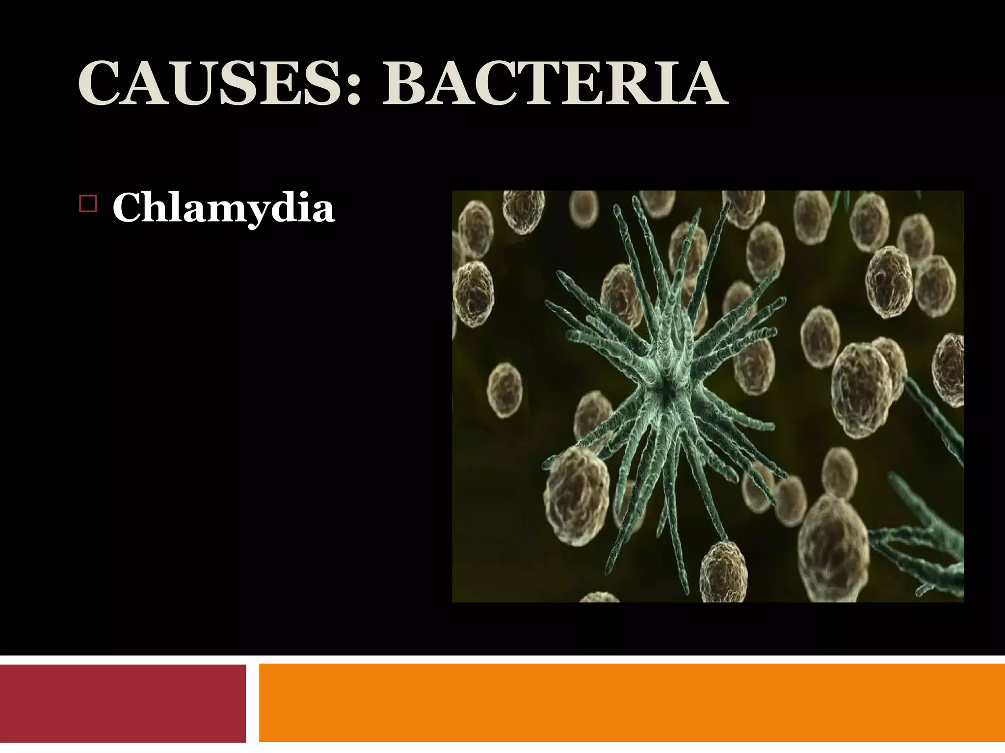 CAUSES: BACTERIA
 Chlamydia
 