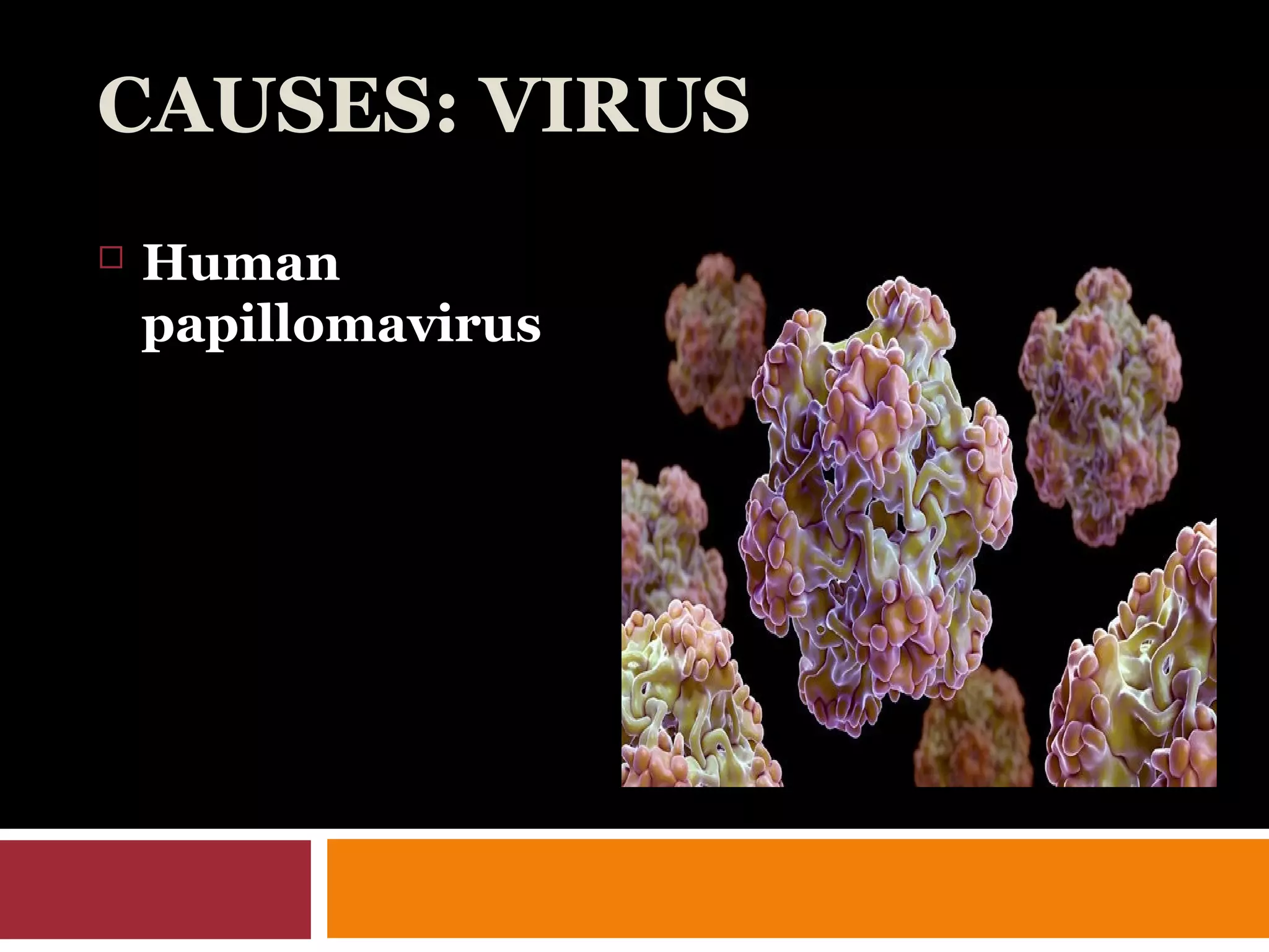 CAUSES: VIRUS
 Human
papillomavirus
 