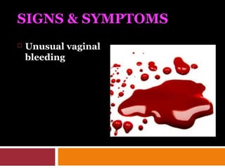 SIGNS & SYMPTOMS
 Unusual vaginal
bleeding
 