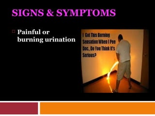 SIGNS & SYMPTOMS
 Painful or
burning urination
 