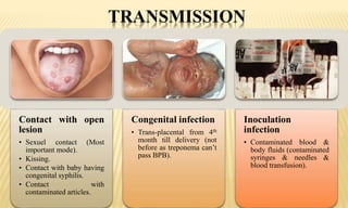 TRANSMISSION
Contact with open
lesion
• Sexuel contact (Most
important mode).
• Kissing.
• Contact with baby having
congenital syphilis.
• Contact with
contaminated articles.
Congenital infection
• Trans-placental from 4th
month till delivery (not
before as treponema can’t
pass BPB).
Inoculation
infection
• Contaminated blood &
body fluids (contaminated
syringes & needles &
blood transfusion).
 