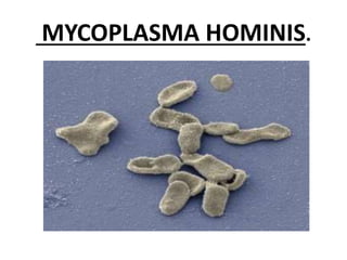 MYCOPLASMA HOMINIS.
 