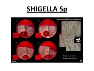 SHIGELLA Sp
 