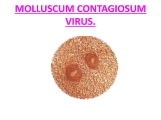 MOLLUSCUM CONTAGIOSUM
VIRUS.
 