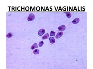 TRICHOMONAS VAGINALIS
 