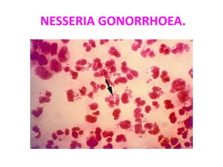 NESSERIA GONORRHOEA.
 