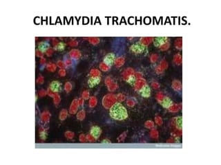 CHLAMYDIA TRACHOMATIS.
 