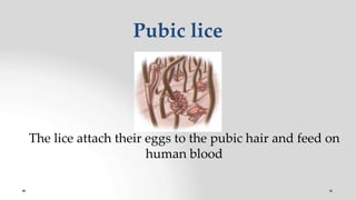 Pubic lice
The lice attach their eggs to the pubic hair and feed on
human blood
 