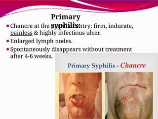 Comprehensive Overview of Sexually Transmitted Diseases and Their ...
