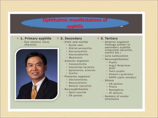 Ophthalmic manifestations of
syphilis