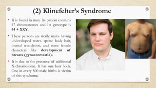 (2) Klinefelter’s Syndrome
• It is found in man. Its patient contains
47 chromosomes and Its genotype is
44 + XXY.
• These persons are sterile males having
undeveloped testes. sparse body hair,
mental retardation, and some female
characters like development of
breasts (gynaecomastia).
• It is due to the presence of additional
X-chromosome. It has one barr body.
One in every 500 male births is victim
of this syndrome.
 