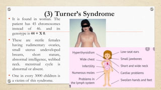 (3) Turner’s Syndrome
• It is found in woman. The
patient has 45 chromosomes
instead of 46. and its
genotype is 44 + X 0.
• These are sterile females
having rudimentary ovaries,
small uterus undeveloped
breasts, short stature,
abnormal intelligence, webbed
neck. menstrual cycle is
abnormal or absent.
• One in every 3000 children is
a victim of this syndrome.
 