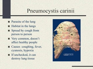 Pneumocystis carinii
Parasite of the lung
Habitat in the lungs
Spread by cough from
person to person
Very common, doesn’t
affect healthy people
Causes coughing, fever,
cyanosis, hypoxia
If unchecked, it can
destroy lung tissue
 