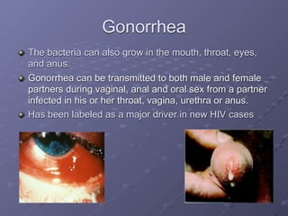 Gonorrhea
The bacteria can also grow in the mouth, throat, eyes,
and anus.
Gonorrhea can be transmitted to both male and female
partners during vaginal, anal and oral sex from a partner
infected in his or her throat, vagina, urethra or anus.
Has been labeled as a major driver in new HIV cases
 