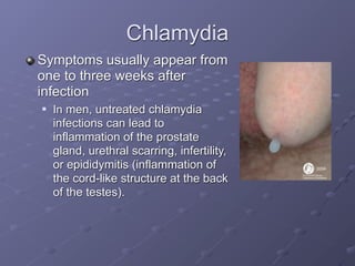 Chlamydia
Symptoms usually appear from
one to three weeks after
infection
   In men, untreated chlamydia
    infections can lead to
    inflammation of the prostate
    gland, urethral scarring, infertility,
    or epididymitis (inflammation of
    the cord-like structure at the back
    of the testes).
 