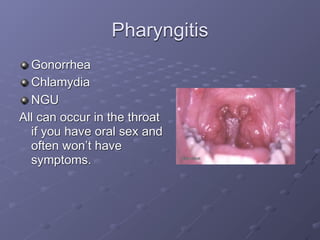 Pharyngitis
  Gonorrhea
  Chlamydia
  NGU
All can occur in the throat
  if you have oral sex and
  often won’t have
  symptoms.
 