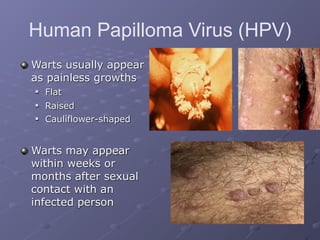 Human Papilloma Virus (HPV)
Warts usually appear
as painless growths
   Flat
   Raised
   Cauliflower-shaped


Warts may appear
within weeks or
months after sexual
contact with an
infected person
 