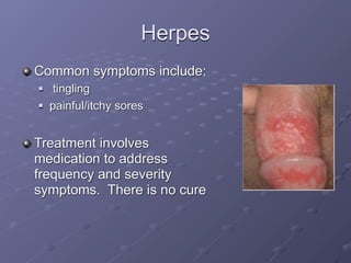 Herpes
Common symptoms include:
   tingling
   painful/itchy sores


Treatment involves
medication to address
frequency and severity
symptoms. There is no cure
 