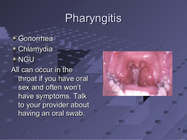 throat gonorrhea symptoms