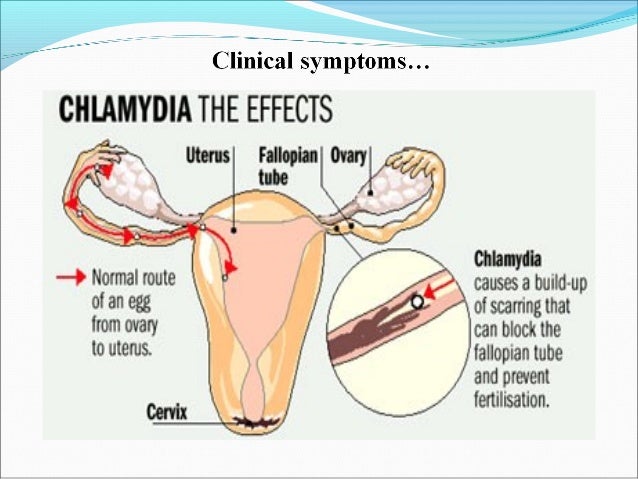 the disease state of chlamydia Centers for disease control and prevention 2 indiana state org/diseases-conditions 5 indiana state department of. the disease state of chlamydia Centers for disease control and prevention 2 indiana state org/diseases-conditions 5 indiana state department of.