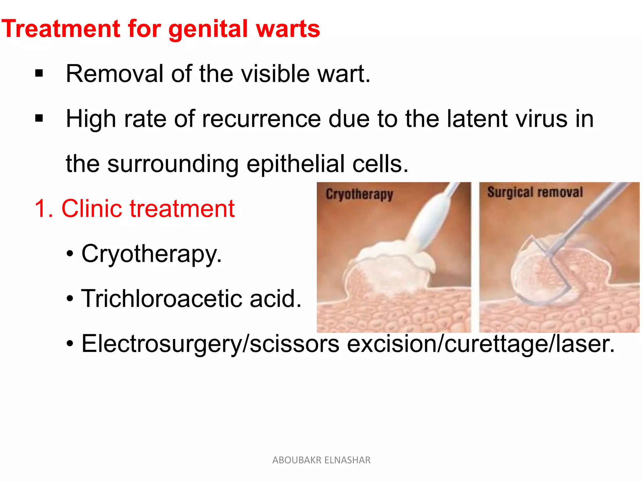 Treatment for genital warts
 Removal of the visible wart.
 High rate of recurrence due to the latent virus in
the surrounding epithelial cells.
1. Clinic treatment
• Cryotherapy.
• Trichloroacetic acid.
• Electrosurgery/scissors excision/curettage/laser.
ABOUBAKR ELNASHAR
 